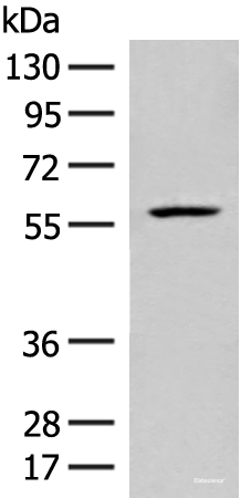 Western blot analysis of Mouse liver tissue lysate using FKTN Polyclonal Antibody at dilution of 1:450