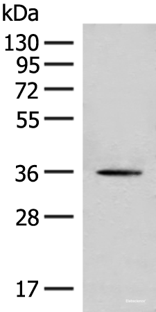 Western blot analysis of Hela cell lysate using MLST8 Polyclonal Antibody at dilution of 1:500