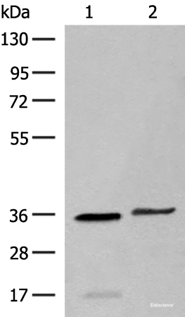 Western blot analysis of Human sigmoid tissue and HT-29 cell lysates using LGALS4 Polyclonal Antibody at dilution of 1:400