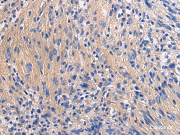 Immunohistochemistry of paraffin-embedded Human brain tissue using GALR3 Polyclonal Antibody at dilution of 1:50(×200)