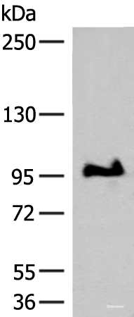 Western blot analysis of TM4 cell lysate using GANC Polyclonal Antibody at dilution of 1:550