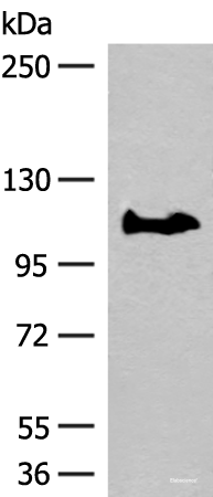 Western blot analysis of PC-3 cell lysate using GARNL3 Polyclonal Antibody at dilution of 1:400