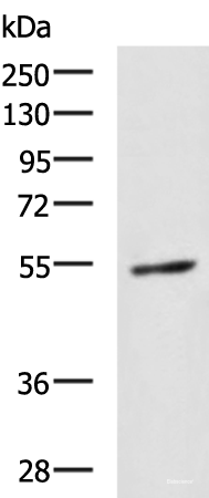 Western blot analysis of 231 cell lysate using GBA Polyclonal Antibody at dilution of 1:1350