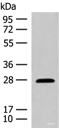 Western blot analysis of Mouse eye tissue lysate using GUCA1B Polyclonal Antibody at dilution of 1:500