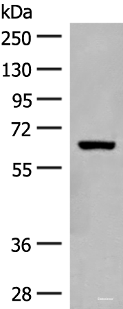 Western blot analysis of Mouse liver tissue lysate using GLS2 Polyclonal Antibody at dilution of 1:400