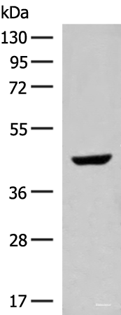 Western blot analysis of Human fetal liver tissue lysate using GNAT1 Polyclonal Antibody at dilution of 1:250