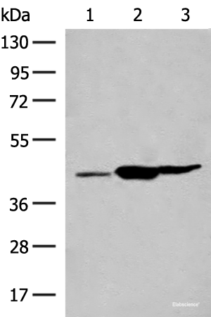 Western blot analysis of Mouse liver tissue Mouse kidney tissue Rat brain tissue lysates using GPR22 Polyclonal Antibody at dilution of 1:500