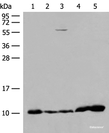 Western blot analysis of 293T cell Human fetal liver tissue Human heart tissue lysates using ATP5I Polyclonal Antibody at dilution of 1:200