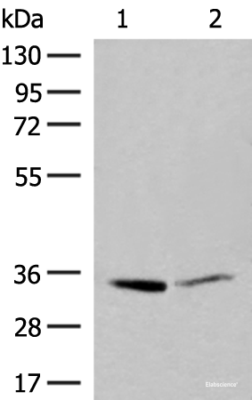 Western blot analysis of A375 and Hela cell lysates using LDHA Polyclonal Antibody at dilution of 1:400