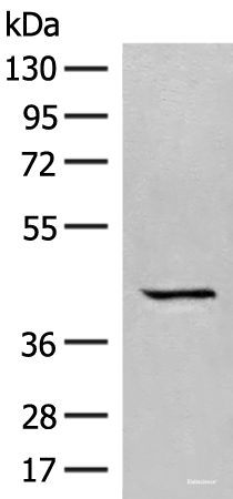 Western blot analysis of A549 cell lysate using GPR62 Polyclonal Antibody at dilution of 1:350