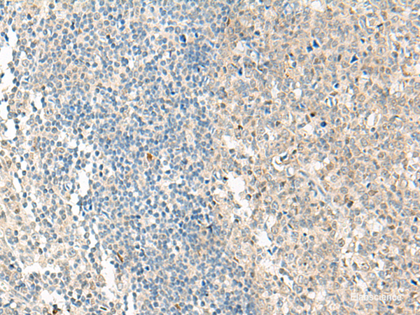 Immunohistochemistry of paraffin-embedded Human tonsil tissue using NPBWR1 Polyclonal Antibody at dilution of 1:50(×200)