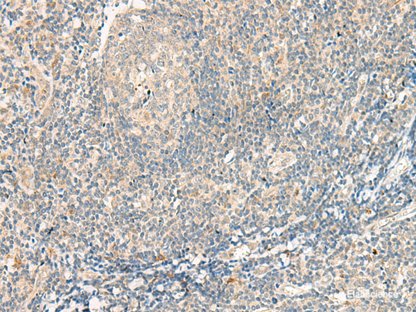 Immunohistochemistry of paraffin-embedded Human tonsil tissue using GPR75 Polyclonal Antibody at dilution of 1:95(×200)