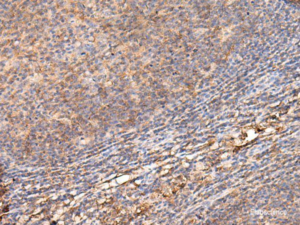 Immunohistochemistry of paraffin-embedded Human tonsil tissue using ADGRA1 Polyclonal Antibody at dilution of 1:70(×200)