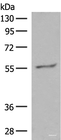 Western blot analysis of Hela cell lysate using GPR161 Polyclonal Antibody at dilution of 1:500