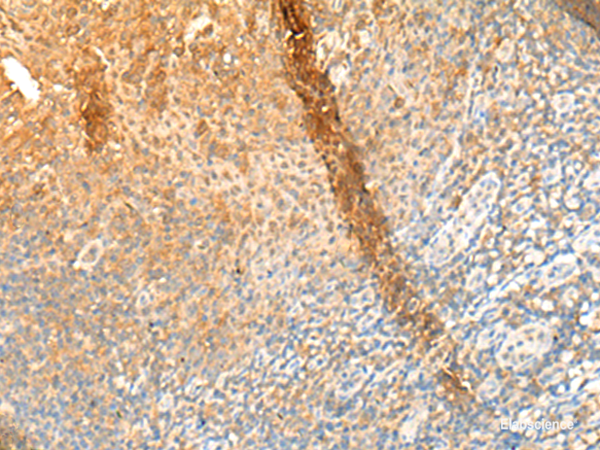 Immunohistochemistry of paraffin-embedded Human tonsil tissue using GPR162 Polyclonal Antibody at dilution of 1:65(×200)