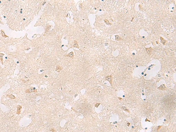Immunohistochemistry of paraffin-embedded Human brain tissue using GPR83 Polyclonal Antibody at dilution of 1:60(×200)