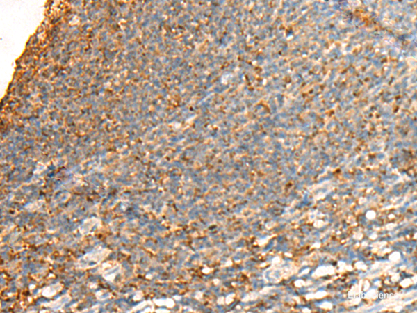 Immunohistochemistry of paraffin-embedded Human tonsil tissue using GPSM2 Polyclonal Antibody at dilution of 1:65(×200)