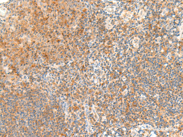 Immunohistochemistry of paraffin-embedded Human tonsil tissue using RAPGEF1 Polyclonal Antibody at dilution of 1:45(×200)