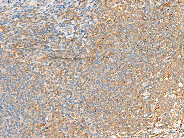 Immunohistochemistry of paraffin-embedded Human tonsil tissue using GRIK2 Polyclonal Antibody at dilution of 1:55(×200)