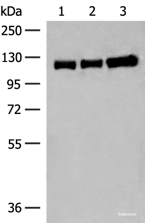 Western blot analysis of Human cerebella tissue Human cerebrum tissue and Human fetal brain tissue lysates using GRIK3 Polyclonal Antibody at dilution of 1:400