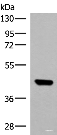 Western blot analysis of TM4 cell lysate using GTF3A Polyclonal Antibody at dilution of 1:550