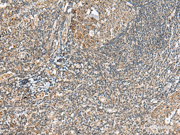 Immunohistochemistry of paraffin-embedded Human tonsil tissue using MOB2 Polyclonal Antibody at dilution of 1:40(×200)