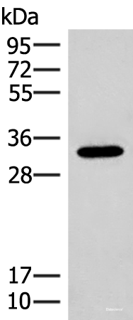 Western blot analysis of Mouse liver tissue lysate using RGR Polyclonal Antibody at dilution of 1:300