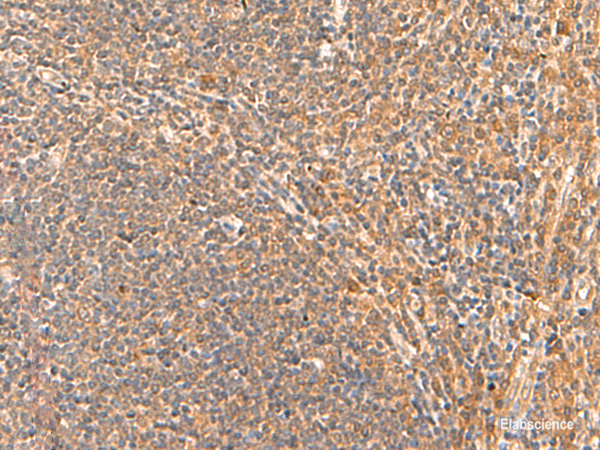 Immunohistochemistry of paraffin-embedded Human tonsil tissue using HPCA Polyclonal Antibody at dilution of 1:55(×200)