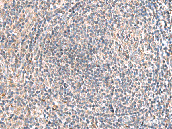 Immunohistochemistry of paraffin-embedded Human tonsil tissue using HLA-DOB Polyclonal Antibody at dilution of 1:45(×200)