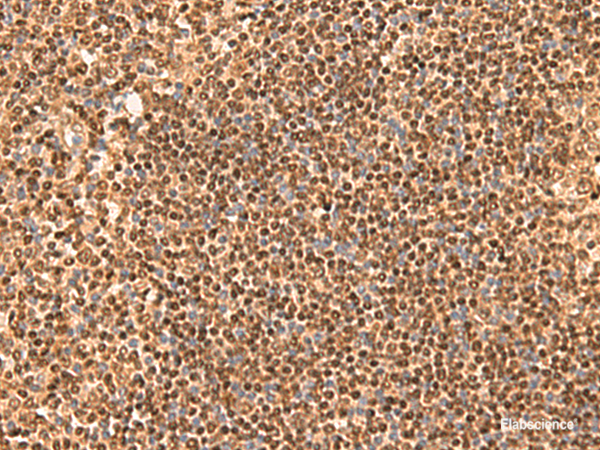 Immunohistochemistry of paraffin-embedded Human tonsil tissue using SIX6 Polyclonal Antibody at dilution of 1:50(×200)