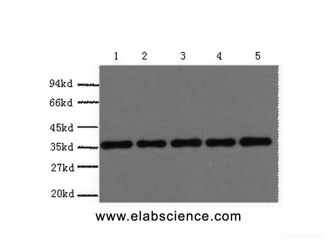 Western Blot analysis of 293T, Rat brain, NIH, 3T3, Sheep muscle, Rabbit testis using GAPDH Polyclonal Antibody at dilution of 1:5000.