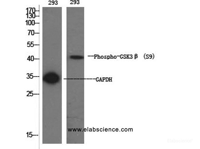 Western Blot analysis of 293 cells using Phospho-GSK3 beta (Ser9) Polyclonal Antibody at dilution of 1:1000