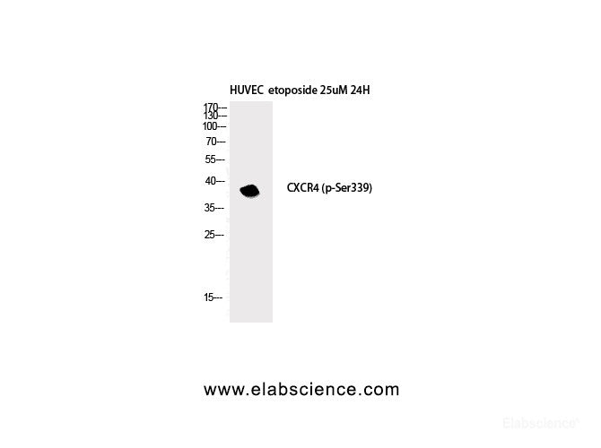 Western Blot analysis of HuvEc etoposide 25uM 24h cells with Phospho-CXCR4 (Ser339) Polyclonal Antibody