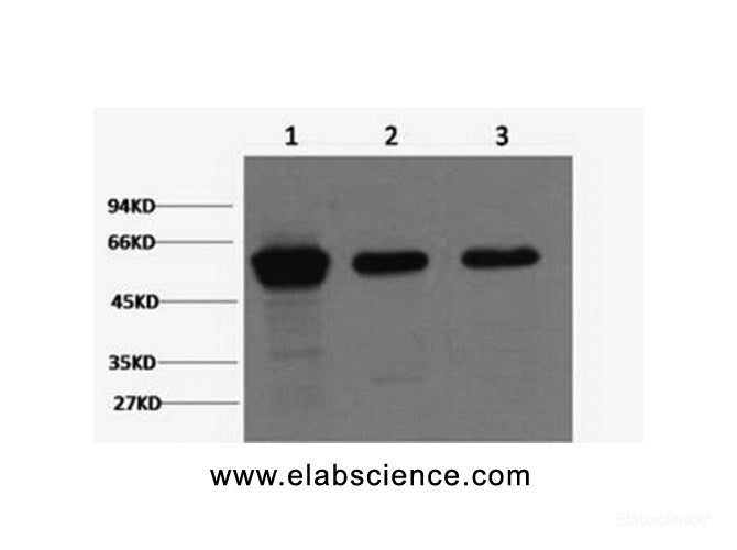 Western Blot analysis of 1) Hela, 2) Mouse brain, 3) Rat brain using Vimentin Monoclonal Antibody at dilution of 1:2000.
