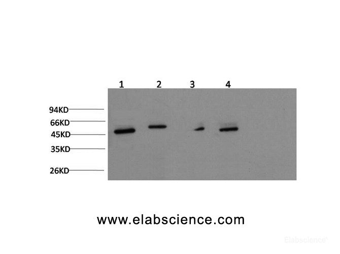 Western Blot analysis of Jurkat, Hela, Mouse brain, Rat brain using gamma Tubulin Monoclonal Antibody at dilution of 1:1000.