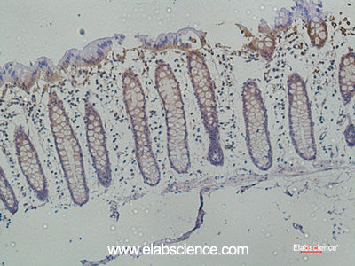 Immunohistochemistry of paraffin-embedded Human colon using Galectin 3 Monoclonal Antibody at dilution of 1:50.