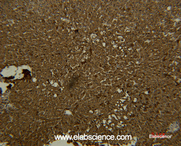 Immunohistochemistry of paraffin-embedded Human liver tissue using Transferrin Monoclonal Antibody at dilution of 1:50.