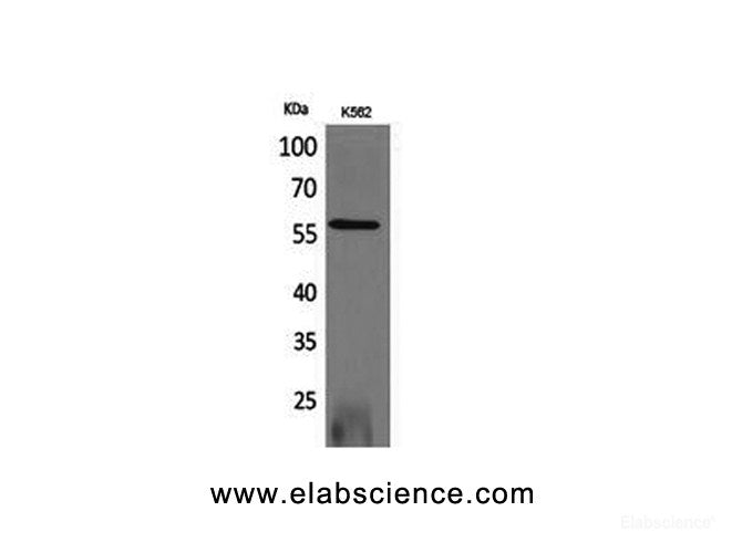 Western Blot analysis of K562 cells with RUNX2 Polyclonal Antibody.
