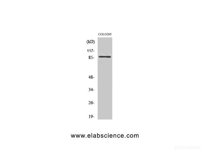 Western Blot analysis of Jurkat cells using FOXO3 Polyclonal Antibody at dilution of 1:1000.