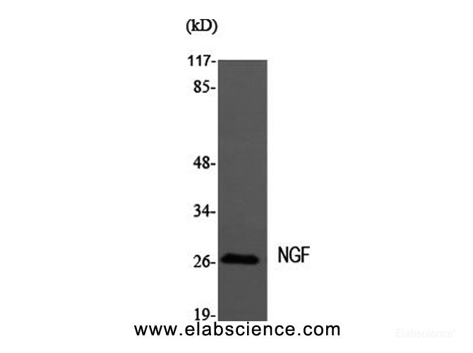 Western Blot analysis of MEF1 cells using NGF Polyclonal Antibody at dilution of 1:2000.