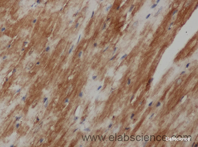 Immunohistochemistry of paraffin-embedded Mouse heart using beta Amyloid Polyclonal Antibody at dilution of 1:50