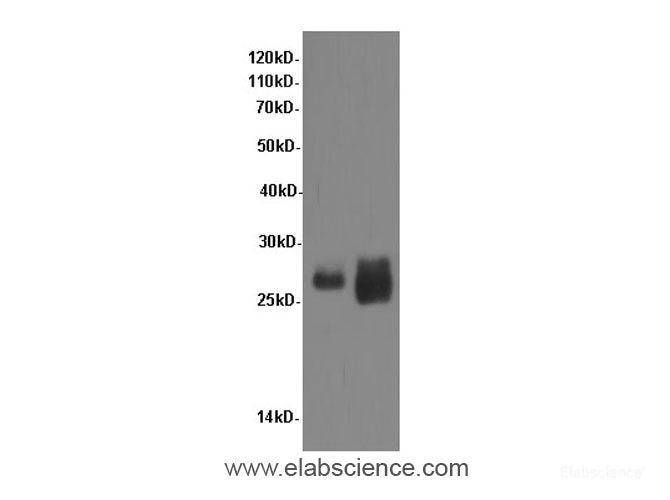 Western Blot analysis of Rat kidney and Mouse kidney tissue using TNF alpha Polyclonal Antibody at dilution of 1:600