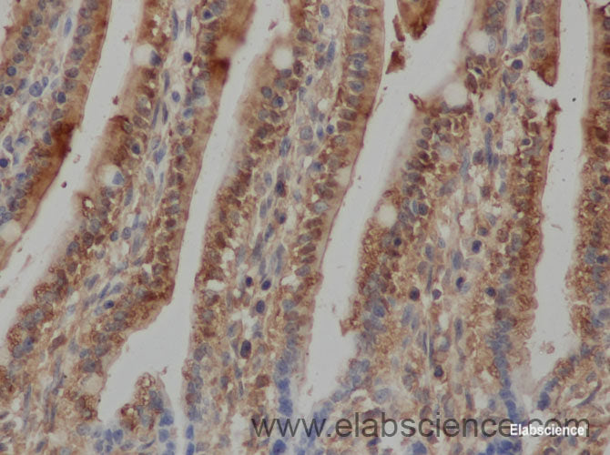 Immunohistochemistry of paraffin-embedded Rat ileum using FABP2 Polyclonal Antibody at dilution of 1:50