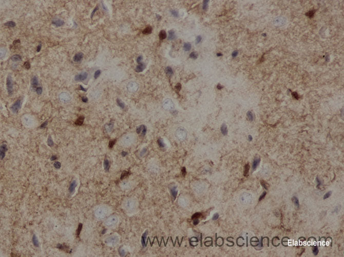 Immunohistochemistry of paraffin-embedded Rat brain using S100B Polyclonal Antibody at dilution of 1:50