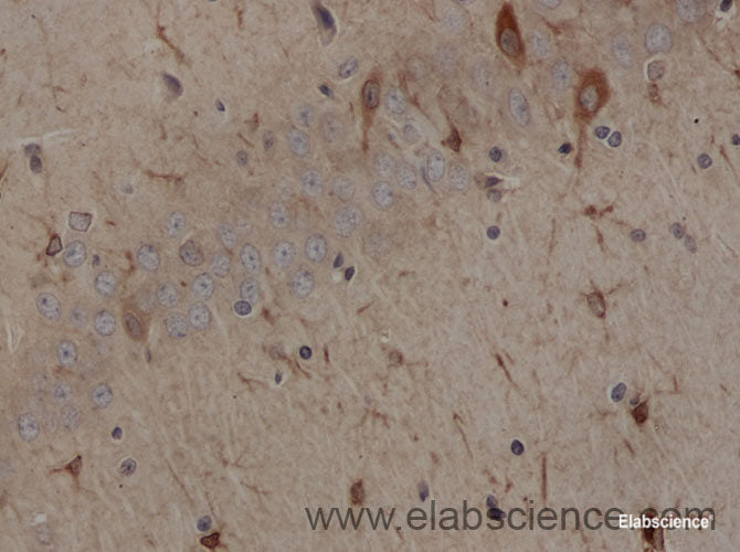 Immunohistochemistry of paraffin-embedded Rat brain using MUC5AC Polyclonal Antibody at dilution of 1:50