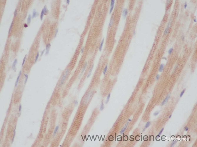 Immunohistochemistry of paraffin-embedded Mouse heart using CD207 Polyclonal Antibody at dilution of 1:50