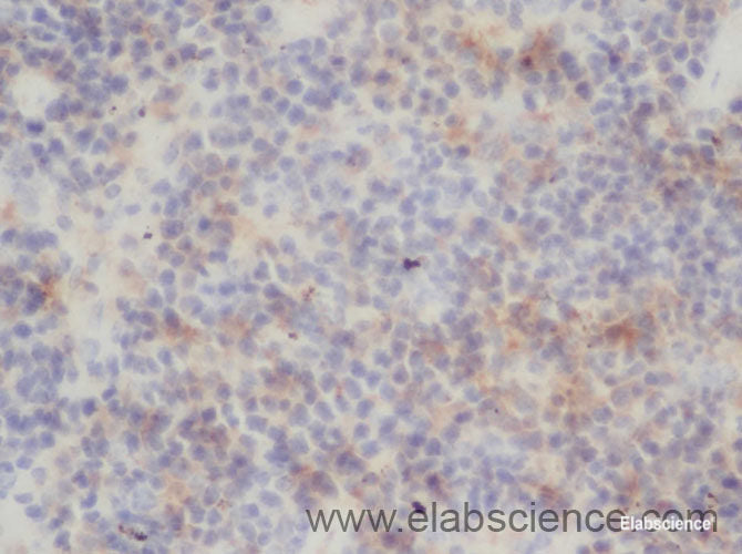 Immunohistochemistry of paraffin-embedded Rat spleen using RELB Polyclonal Antibody at dilution of 1:50