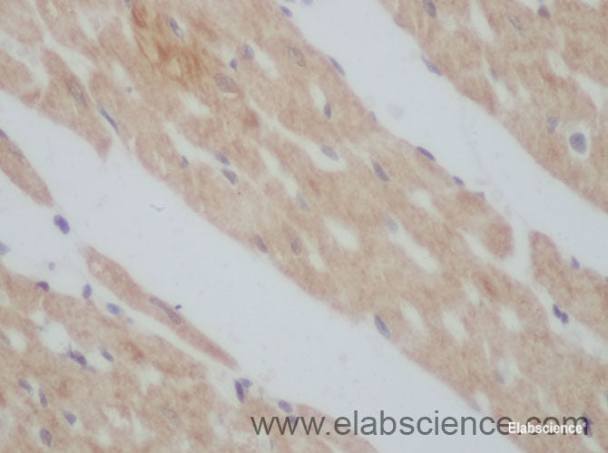 Immunohistochemistry of paraffin-embedded Mouse heart using TGF β Receptor II Polyclonal Antibody at dilution of 1:50