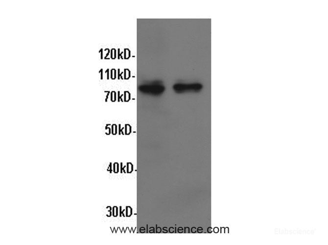 Western Blot analysis of Hela and A549 cells using STAT1 Polyclonal Antibody at dilution of 1:600