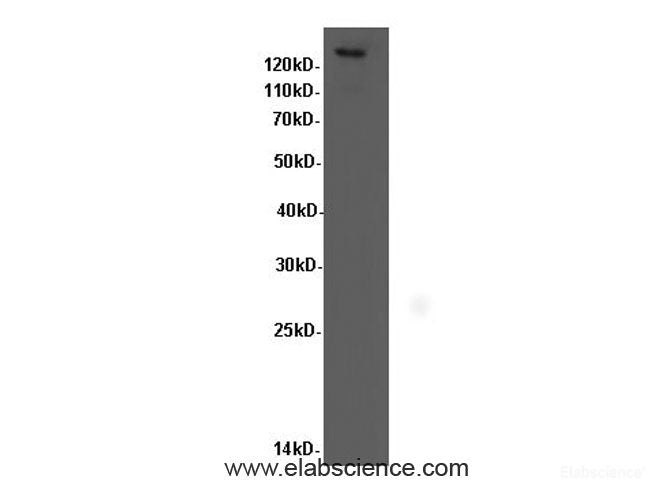Western Blot analysis of Hela cells using ITGB1 Polyclonal Antibody at dilution of 1:600